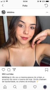 De borest ?????